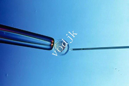 東京試管嬰兒技術(shù)成功率高達(dá)50%以上，日本優(yōu)勢(shì)如何助力生育夢(mèng)想成真？