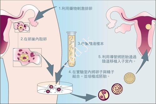 2026年南寧市三代試管包試管成功是真的嗎？詳細(xì)流程與注意事項分享